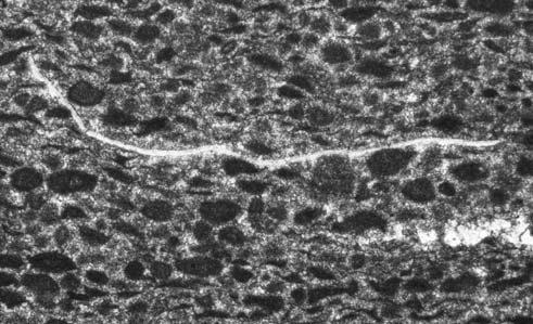 Laminacje maj¹ genezê mikrobialn¹ lub s¹ zwi¹zane z obecnoœci¹ osadów detrytycznych (ryc. 3C).