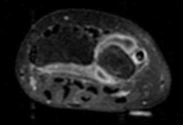 J Rheumatol 2014;41:1630;Steenbergen HW Ann Rheum Dis 2015;74:1225; Colebatch AN et al.