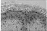 keratynosomów strefy zamykające łączące keratynocyty warstwy ziarnistej 2.