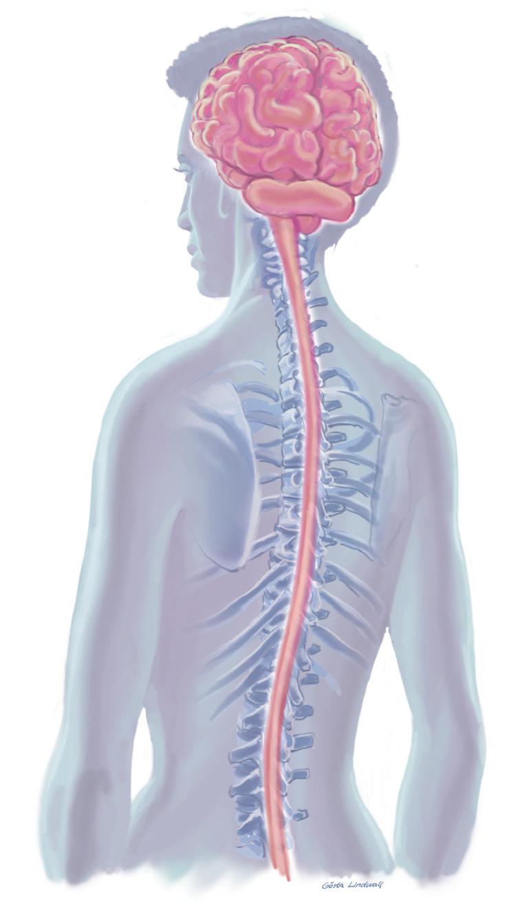 STWARDNIENIE ROZSIANE KRÓTKI OPIS W stwardnieniu rozsianym (SM) występuje stan zapalny, który zakłóca przewodzenie sygnałów elektrycznych pomiędzy komórkami nerwowymi w ośrodkowym układzie nerwowym.