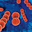 Te Gram(-) bakterie, o klinicznym znaczeniu dorównującym MRSA, charakteryzują się pełną wrażliwością na przeciwdrobnoustrojowe działanie oktenidyny 4.