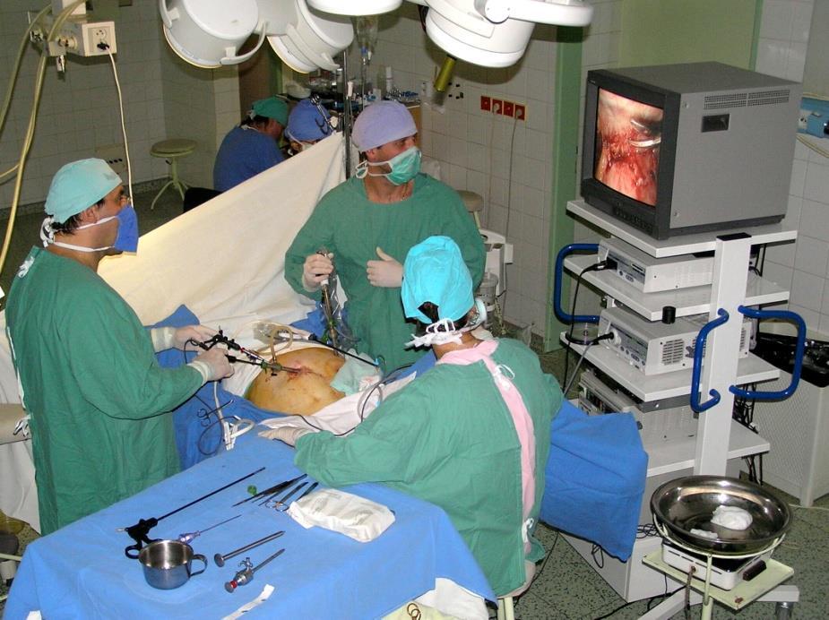 Cholecystektomia Cholecystektomia 1992 teraz 50 99 % Metoda wyboru Nierozwiązane problemy z kamicą przewodową splitting, współpraca