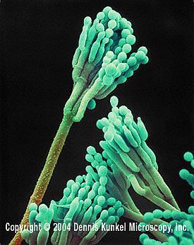 [2004 Dennis Kunkel, Microscopy] Biorozkład materiałów można podzielić na dwa rodzaje: 1.