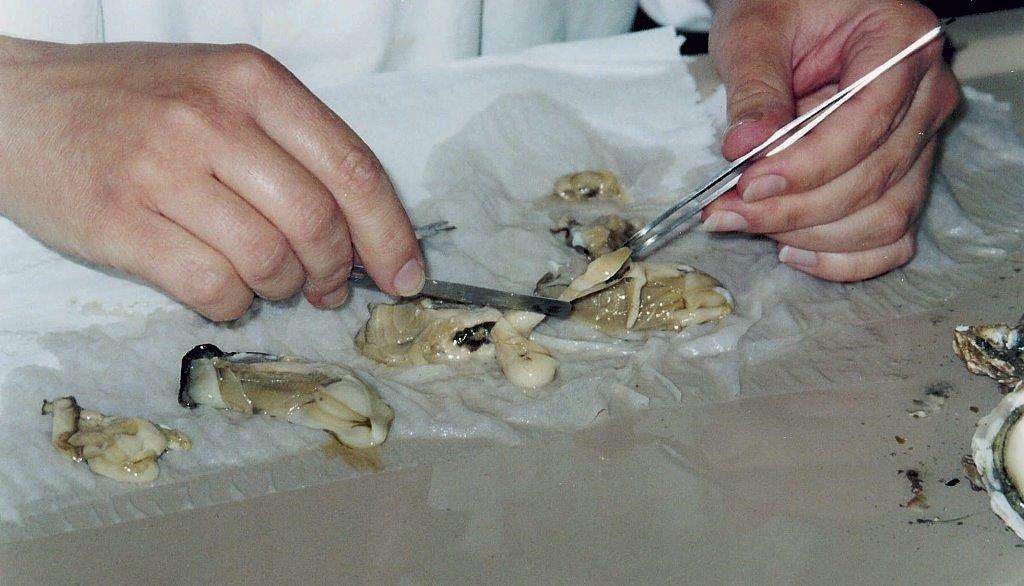 91 towarzyszą objawy podrażnienia ze strony przewodu pokarmowego, czasami kaszel krtaniowy, a nawet obecność pasożytów w plwocinie.
