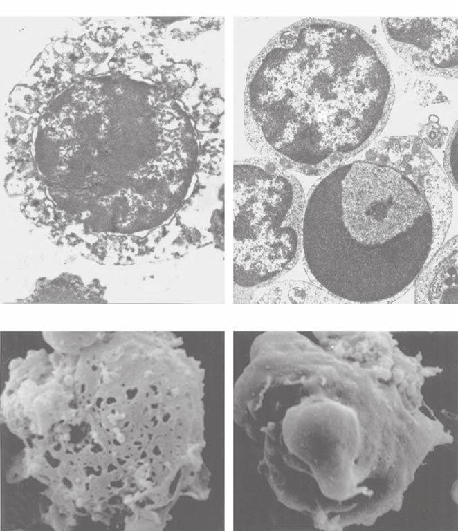 7.1 Mechanizmy molekularne APOPTOZy 163 (a) (b) (c) (d) N A Ryc. 7.