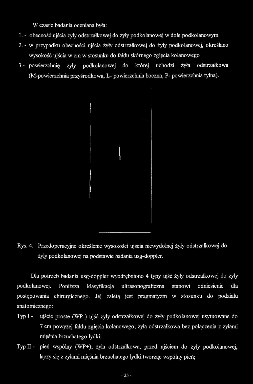 Rys. 4. Przedoperacyjne określenie wysokości ujścia niewydolnej żyły odstrzalkowej do żyły podkolanowej na podstawie badania usg-doppler.