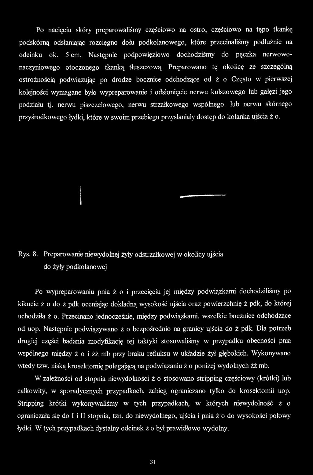 Preparowano tę okolicę ze szczególną ostrożnością podwiązując po drodze bocznice odchodzące od ż o Często w pierwszej kolejności wymagane było wypreparowanie i odsłonięcie nerwu kulszowego lub gałęzi