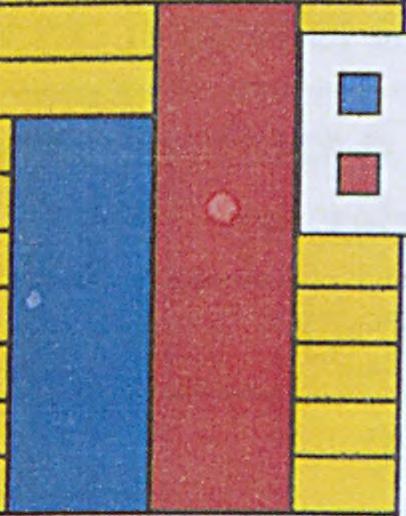 Liczności typów ujść ż o do pdk w poszczególnych kończynach poniżj Wysokość ujścia ż o do żpdk i powyżej 3 cm