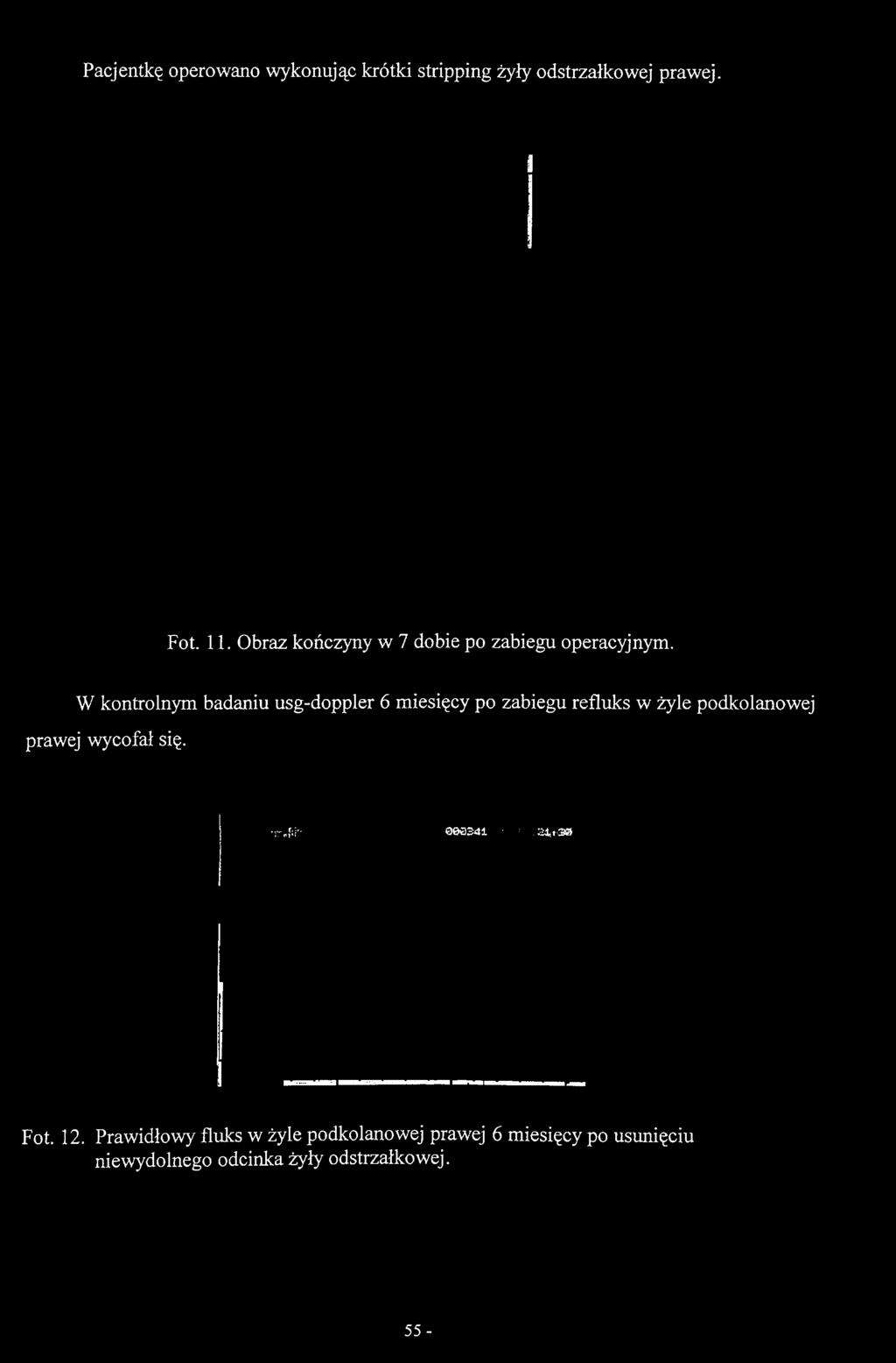 operacyjnym.