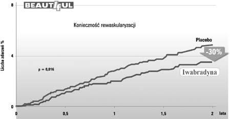 Badanie BEAUTIFUL - wyniki Mediana okresu obserwacji wynosiła 19 miesięcy (maksymalnie 35 miesięcy) [50]. Leczenie było dobrze tolerowane.