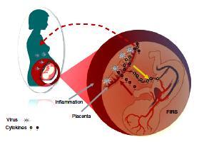 Matka-łożysko-płod: kompleksowa Mor G. Am.J.Reprod.Immunol. 2010,63: 425 odpowiedź na infekcje Łożysko to narząd odpornościowy, a nie bariera oddzielająca płód od matki.