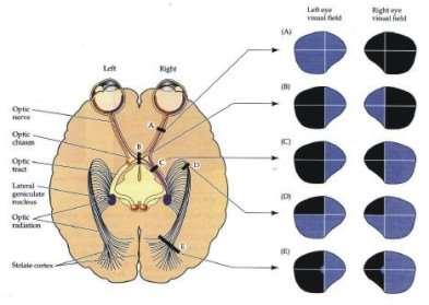 Reprezentacja pola widzenia na różnych etapach drogi wzrokowej do kory mózgu