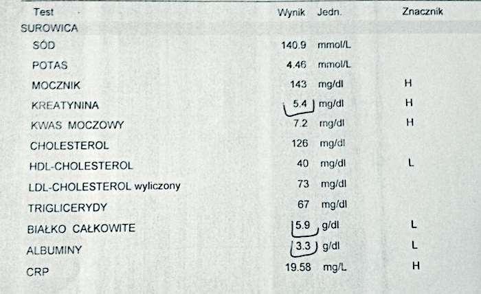 Niewydolność nerek/hipoproteinemia