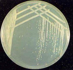 MacConkey agar, Martin Lewis agar
