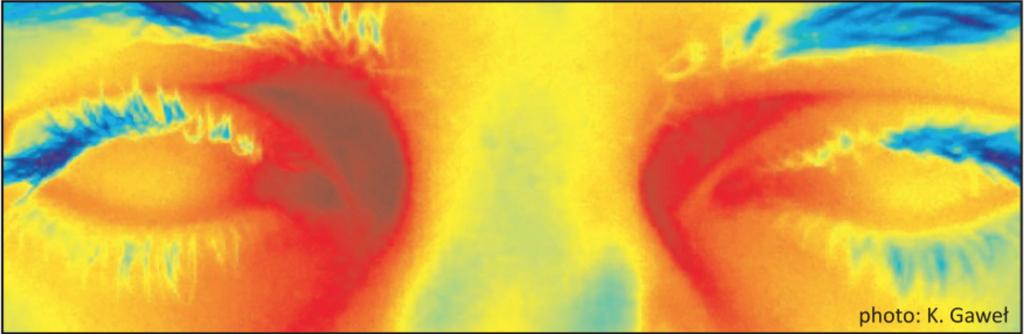 Przykład obrazu termicznego oka (obraz wykonany kamerą FLIR w Laboratorium
