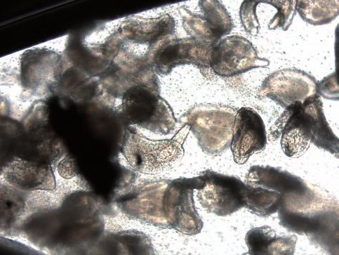 Fot. 3. Inwazja Diplosthomum spathaceum u pstr¹ga têczowego. Fot. 4. Inwazja Gyrodactylus sp. u pstr¹ga têczowego. by³o zaka enie bakteri¹ K. rosea ryb o masie cia³a 216,3-307,4 g.