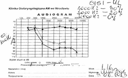 230 Otorynolaryngologia 2015, 14(4): 228-234 podejście wielospecjalistyczne z udziałem głównie neurologa dziecięcego i otolaryngologa, często także kardiologa i psychologa dziecięcego oraz innych