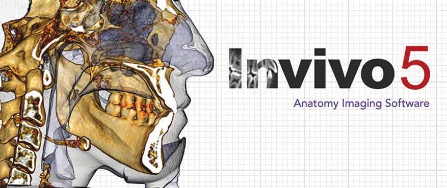 InVivo Dental Oprogramowanie InVivo Dental to zaawansowany program diagnostyczny CBCT skierowany do lekarzy stomatologów różnych specjalności.