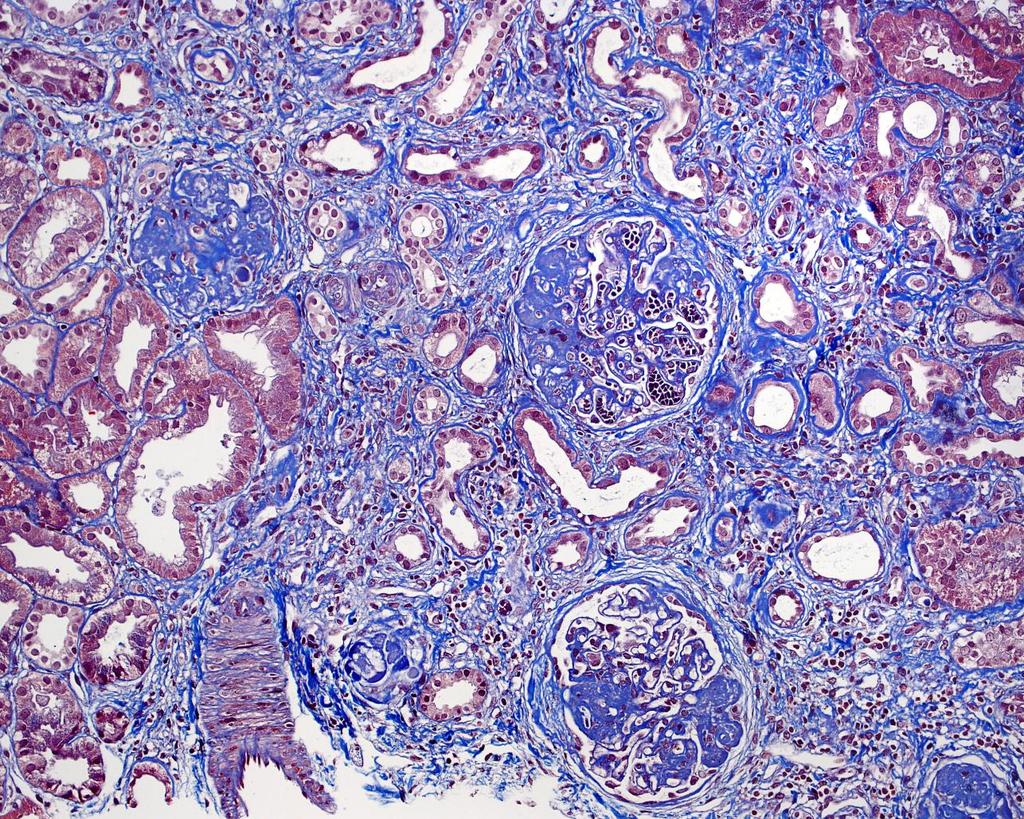 SLE III C