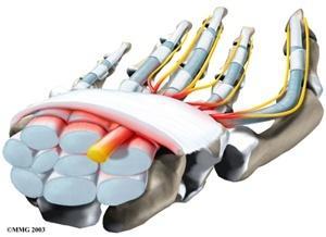 RSI (Repetitive Strain Injury) Zespół Cieśni Nadgarstka. Zespół cieśni nadgarstka jest wywoływany przez długotrwały ucisk nerwu pośrodkowego (nerw biegnący wzdłuż kanału w nadgarstku).