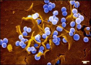 Staphylococus aureus Gronkowiec złocisty