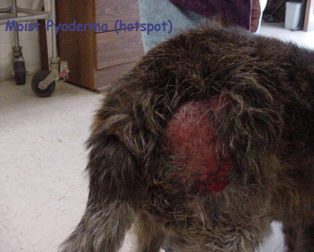 Dermatitis