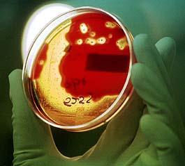 Rodzaj Streptococcus Rodzaj Streptococcus skupia liczne gatunki charakteryzujące się odmiennymi właściwościami fenotypowymi i genotypowymi oraz róźną chorobotwórczością.