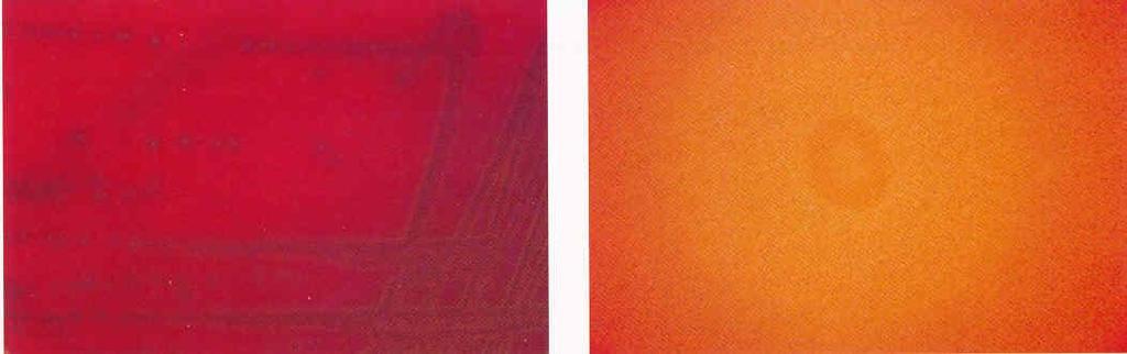 Hemolysis