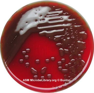 Streptococcus pneumoniae S.