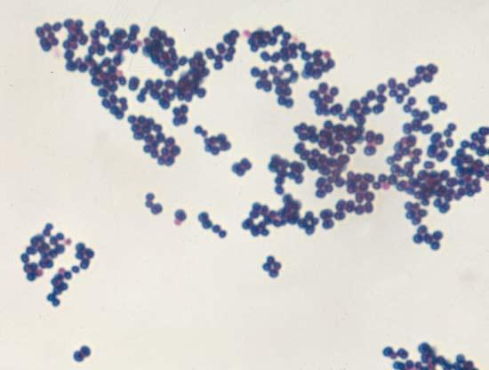 Rodzaj Staphylococcus Gronkowce (Staphylococcus) zaliczamy do bakterii Gram-dodatnich. Morfologicznie są to ziarenkowce występujące w skupiskach, przypominających grona.