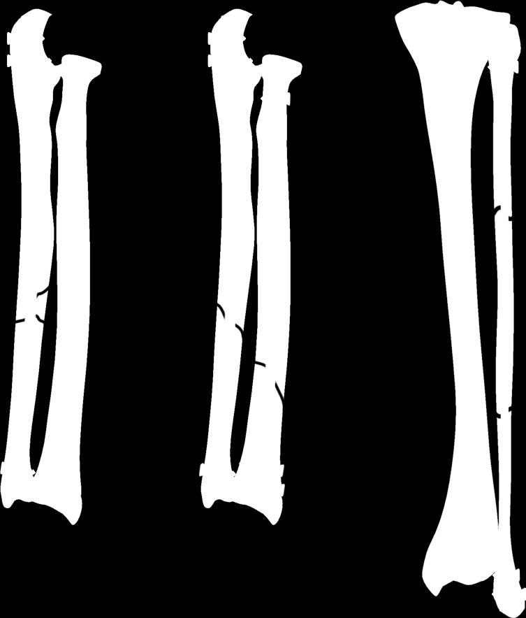 przeprowadzenia implantacji oraz usunięcia implantów po zakończonym okresie leczenia, instrukcja użytkowania instrumentarium.