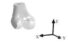 lampy 280 μa, czas pojedynczej projekcji 2s, filtr miedziany 1,5 mm, liczba projekcji 500, rozdzielczość 170,41 um).
