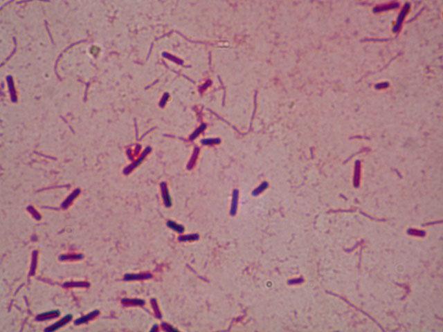 Cl. perfringens Znajdują się zwykle w odchodach, mogą pochodzić z innych źródeł naturalnych.