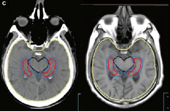dawek [Tsao et al.