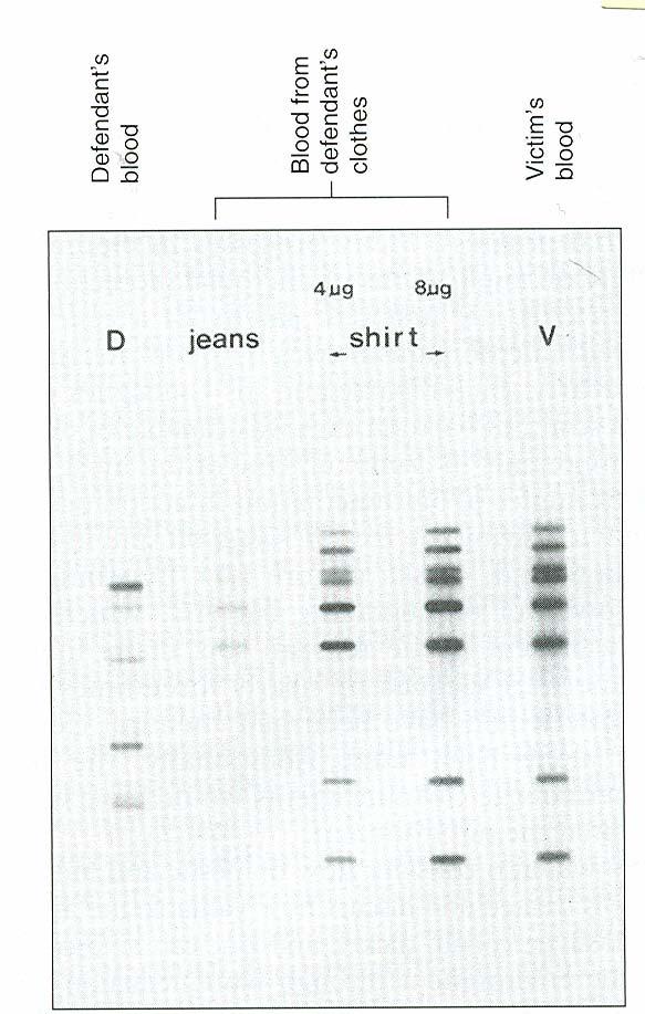 Zastosowanie analizy DNA w postępowaniu powaniu sądowyms DNA z krwi podejrzanego DNA z