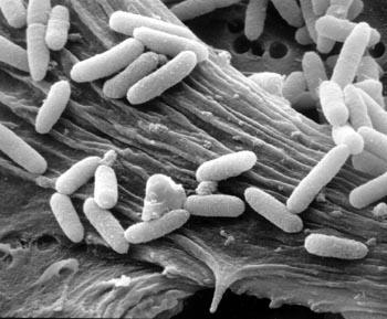 Enteropatogenne E. coli (EPEC) EPEC powodują wodnistą biegunkę zbliżoną do zakażeń ETEC, ale nie mają tych samych czynników warunkujących kolonizacje ani nie produkują ST i LT toksyn.