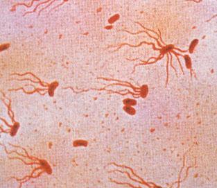 Salmonella enterica W każdym podgatunku występują jeszcze serowary w zależności od występujących antygenów.