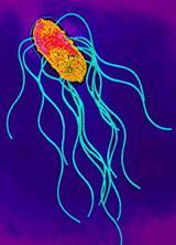 Zakażenia Salmonella Enteritidis Jaja kurze zakażone Salmonella Enteritidis są dużym zagrożeniem zdrowotnym dla ludzi.