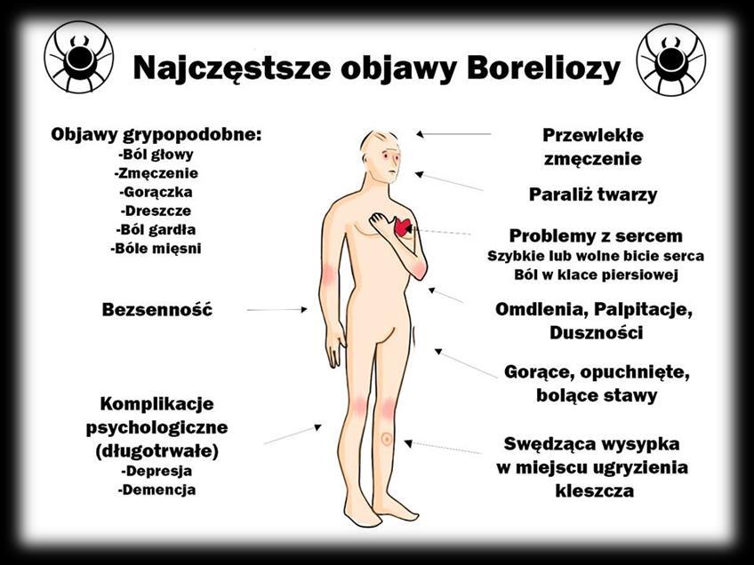 1.5.2. Zakażenia ośrodkowego układu nerwowego W 2017 r. liczba zarejestrowanych zakażeń ośrodkowego układu nerwowego utrzymała się na poziomie zbliżonym do lat poprzednich.