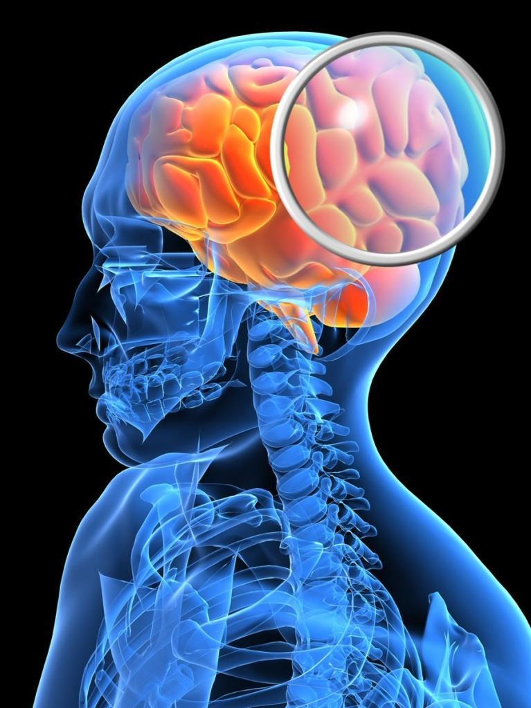Predyktory przebiegu udaru mózgu Stan kliniczny przy przyjęciu Wiek chorego Rozmiar i lokalizacja udaru Mechanizm udaru Choroby współistniejące Odchylenia w badaniach laboratoryjnych CRP,