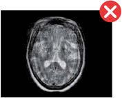 badań MRI oraz TK, dzięki czemu