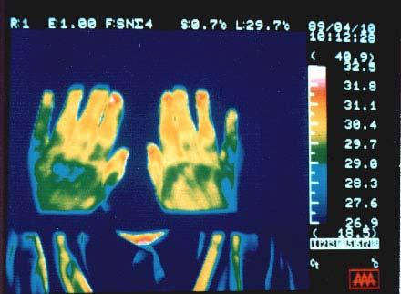 H-116 Rys. H4. Termowizyjna rejestracja telekinetycznej zmiany temperatury. Pokazane tu zdjęcia ilustrują zmiany ciepłoty rąk szwajcarskiej uzdrowicielki, Mrs.
