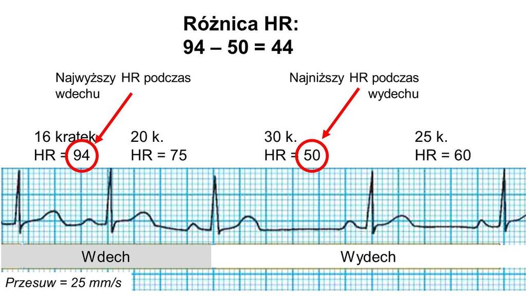 kolejnymi załamkami R i podstaw do poniższego wzoru (tym sposobem uzyskasz wartość HR dla każdego odstępu RR, patrz: ryc.