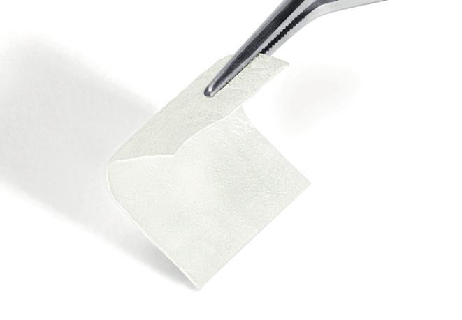 Membrany resorbowalne Błona kolagenowa Symbios Collagen Membrane SR Błona kolagenowa Symbios Collagen Membrane SR (wolnoresorbowalna) jest materiałem bioresorbowalnym.