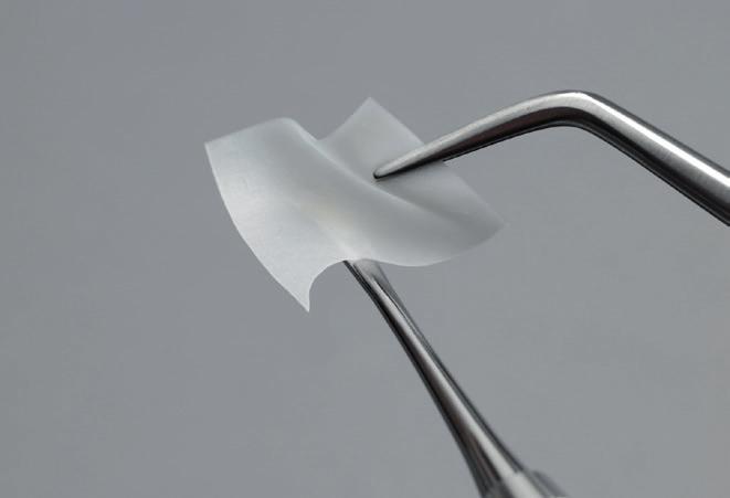 Wstępnie nawilżona błona kolagenowa Symbios Collagen Membrane pre-hydrated Wstępnie nawilżona błona kolagenowa Symbios składa się ze zdrowej oczyszczonej tkanki pozyskanej z osierdzia wołowego.
