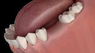Cerec-systemem Strona 22 NOwość
