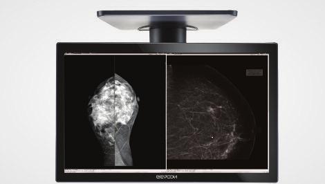Monitory diagnostyczne 2MP 2MP 2MP 2MP 2MP KOLOR KOLOR KOLOR SZAROSC SZAROSC Model produktu C22S+ C22SP+ C24S+ G22S+ G22SP+ Nazwa produktu Rozmiar ekranu Głębia koloru Rozdzielczość Kąty widzenia