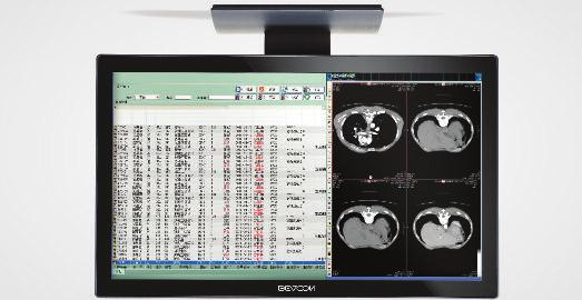 Monitory kliniczne Model produktu C14S G11S H2405 C22W/ C22WT C23W/ C23WT Nazwa produktu Rozmiar ekranu Głębia koloru Rozdzielczość Kąty widzenia Jasność Kontrast Wejścia sygnału Wersje wykonania