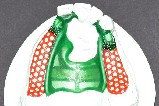 z zatrzaskami) Fot. 18.