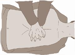 klatki piersiowej (rys. 4), Rys. 4 Miejsce wykonywania uściśnięć ratunkowych przyłóż drugi nadgarstek do pierwszej ręki i spleć palce obu dłoni (rys.